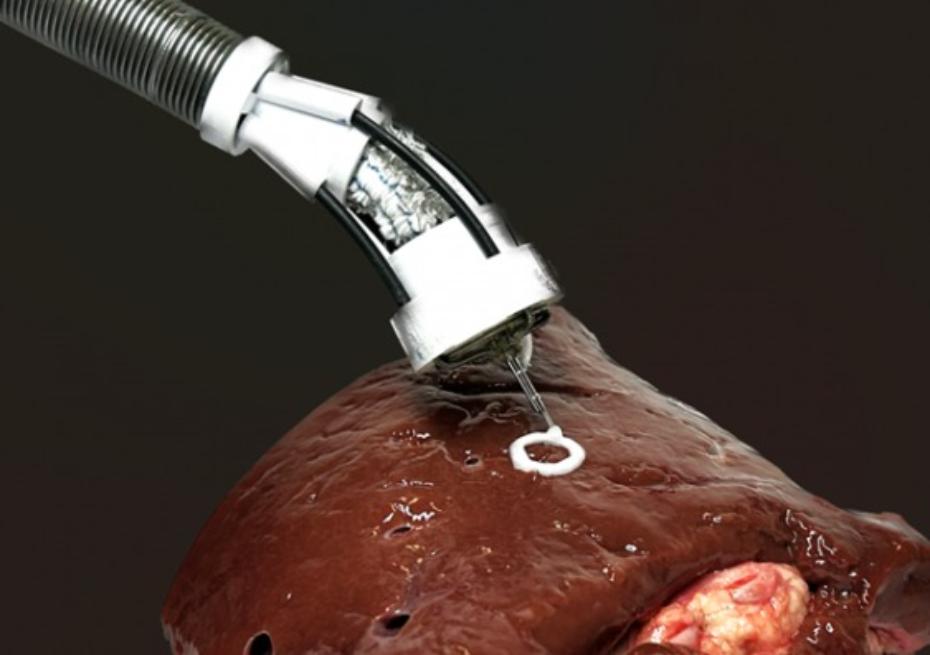 Ученые разрабатывают печать органов внутри тела человека