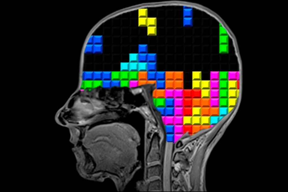 Российский Тетрис спасает от тяжких травм прошлого