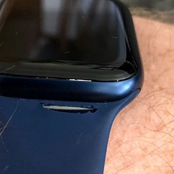 Пользователи жалуются, что ремешок Apple Watch за 4000 руб. рвется. Так выглядит боль
