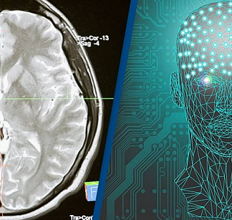 Человеческий мозг впервые подключили к компьютеру беспроводным способом